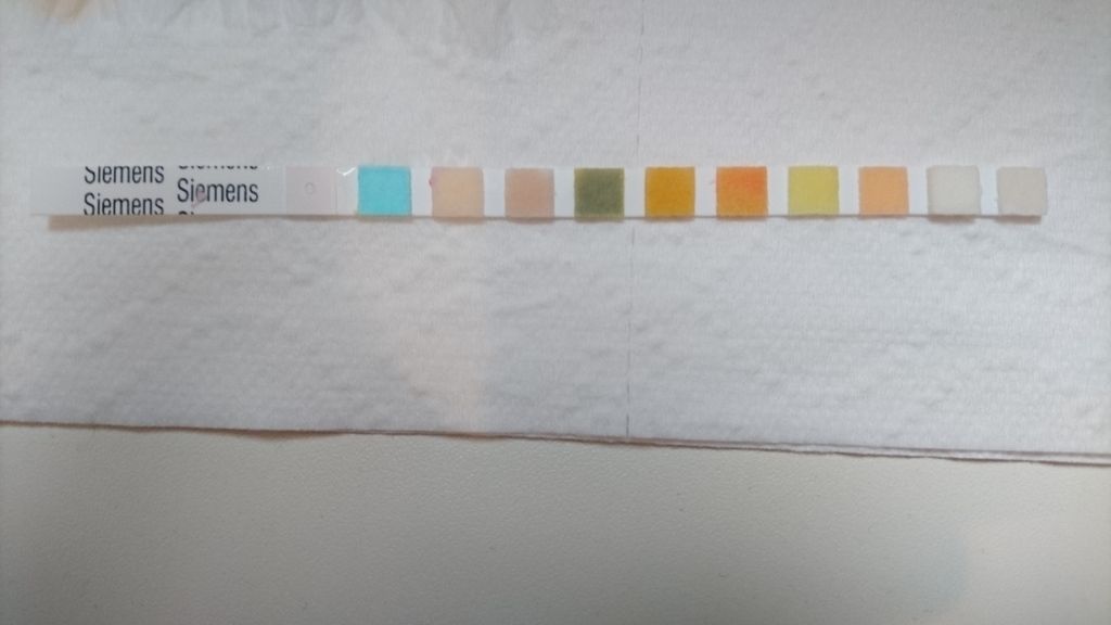 Very high urine PH (8.5) Page 2 BabyCentre